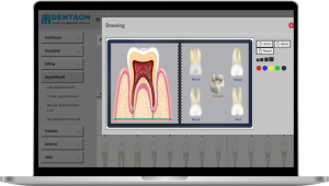 Read more about the article 🦷Gum Disease (Gingivitis & Periodontitis): Causes, Symptoms, and Easy Management with Dental Software